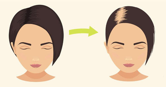 Pomade Hair Loss