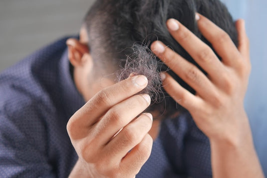 7 Alternatives to Hair Transplant