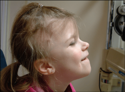 Hair loss treatment for female in Singapore